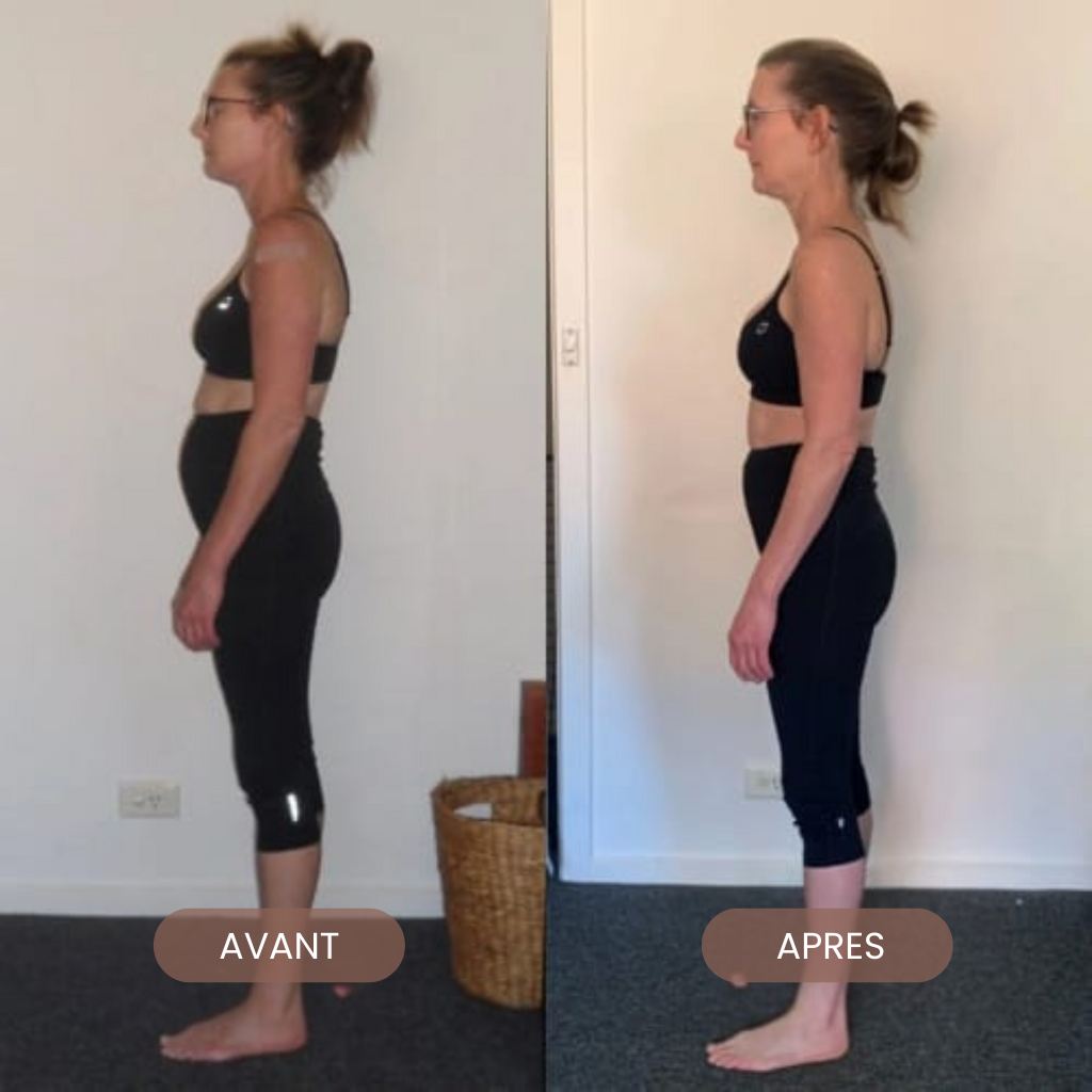 BackEase – Posture made easy