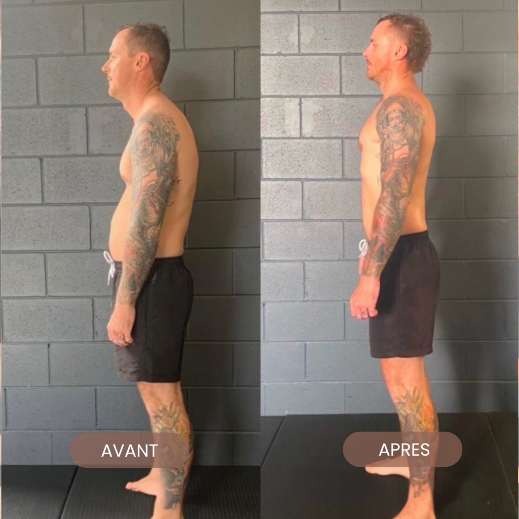 SpineUp – Straighten your back, reveal your confidence